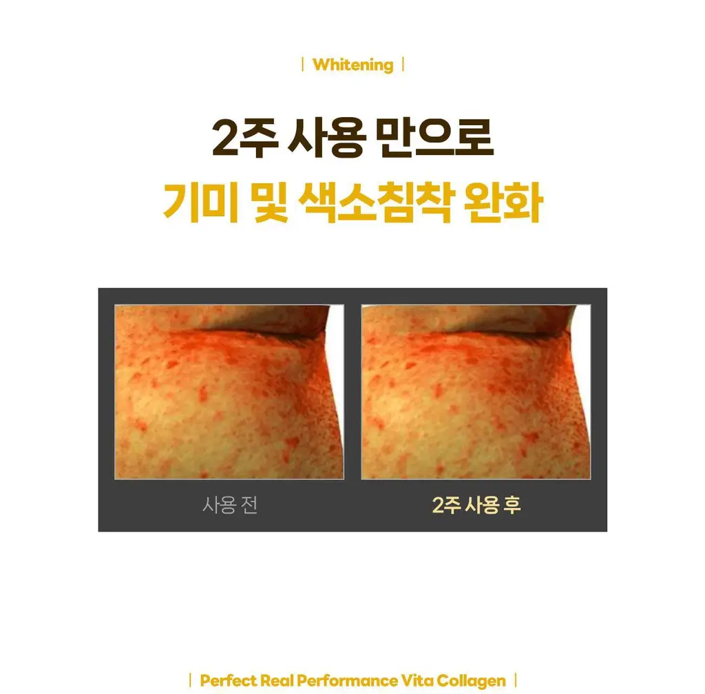 [올리브영 1위] 더마픽스 퍼펙트 퍼포먼스 콜라겐 1+1기획 (3종 1택) 상세페이지 76